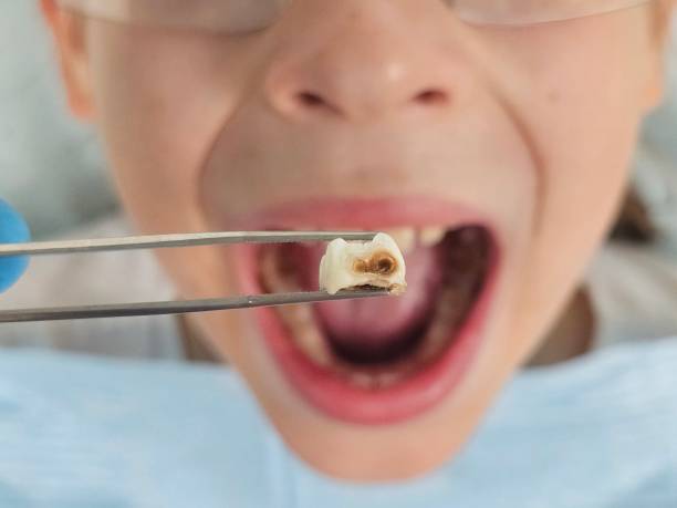 Best Pediatric Emergency Dentist in Charles Town, WV